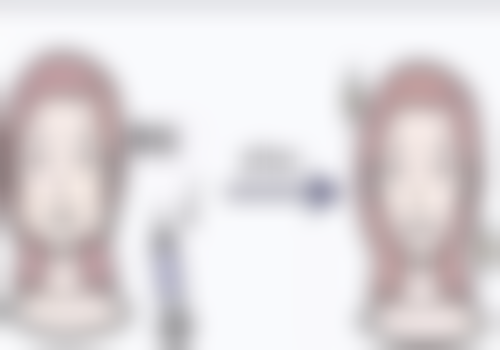 宜兴洵美会整形医院怎么样价格收费