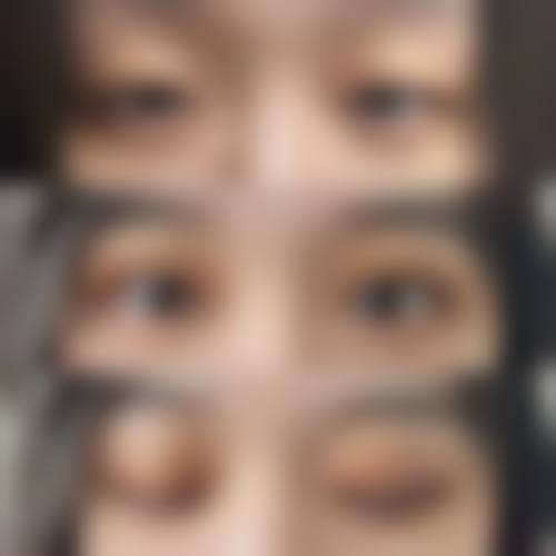 重庆美丽通整形外科医疗美容诊所怎么样求美者反馈