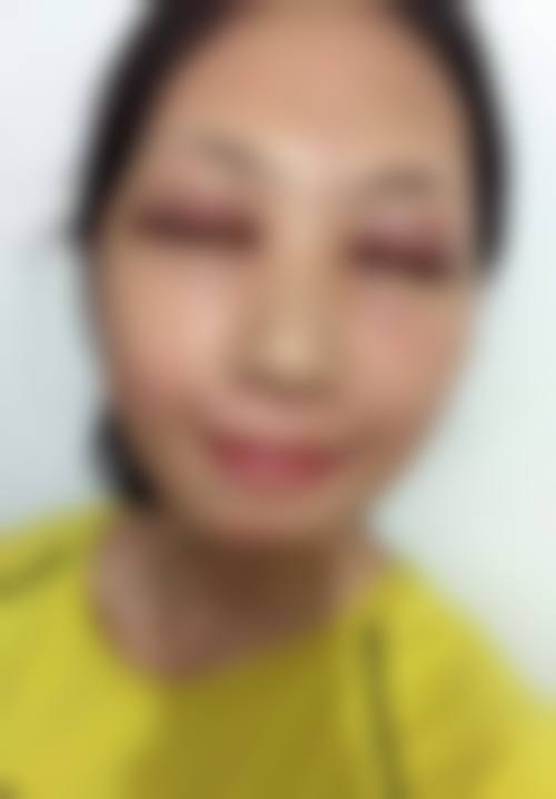 重庆美丽通整形外科医疗美容诊所怎么样价格收费