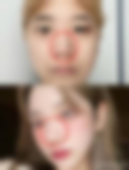 杨承进医生的患者口碑