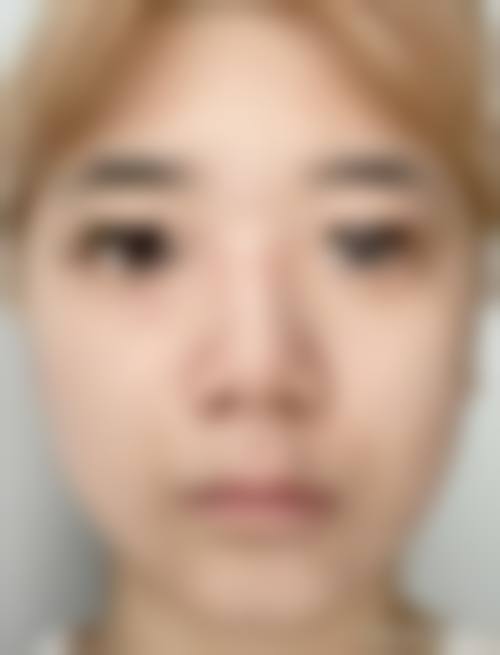 韩国清潭首尔整形外科怎么样来院路线