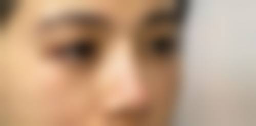 郑荣福医生的成功实例