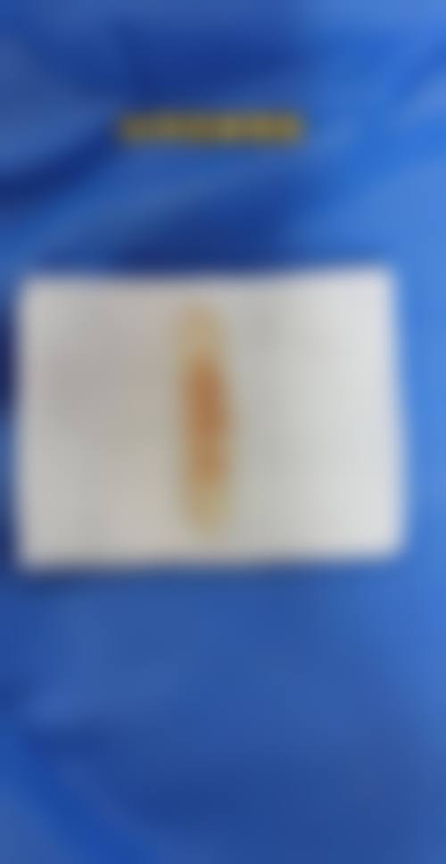 武汉江诚整形外科医院怎么样求美者反馈