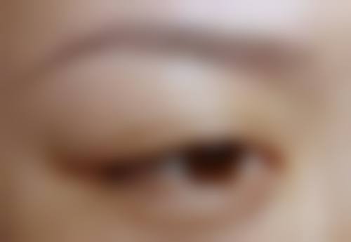 庄洪兴医生的擅长领域