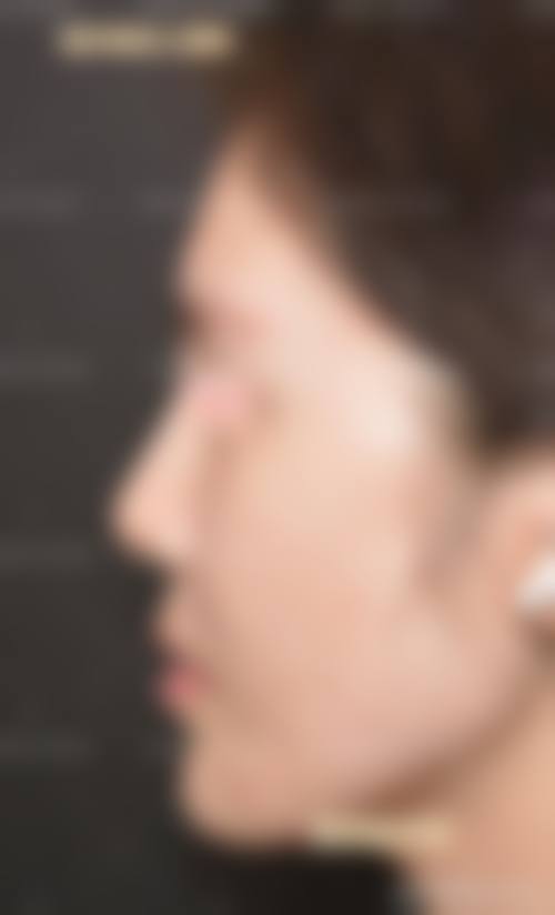 无锡圣美瑞医疗美容门诊部怎么样求美者反馈