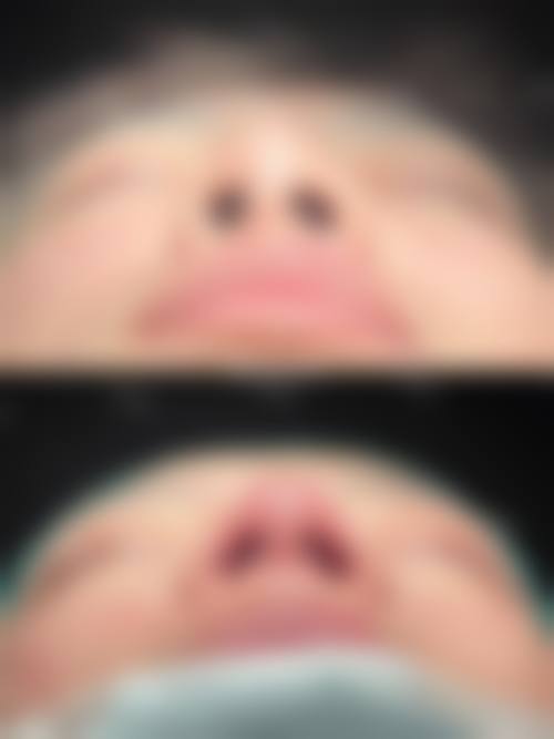 无锡圣美瑞医疗美容门诊部怎么样价格收费