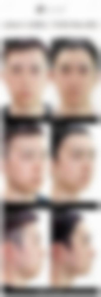 韩国清潭首尔整形外科怎么样医生团队实力