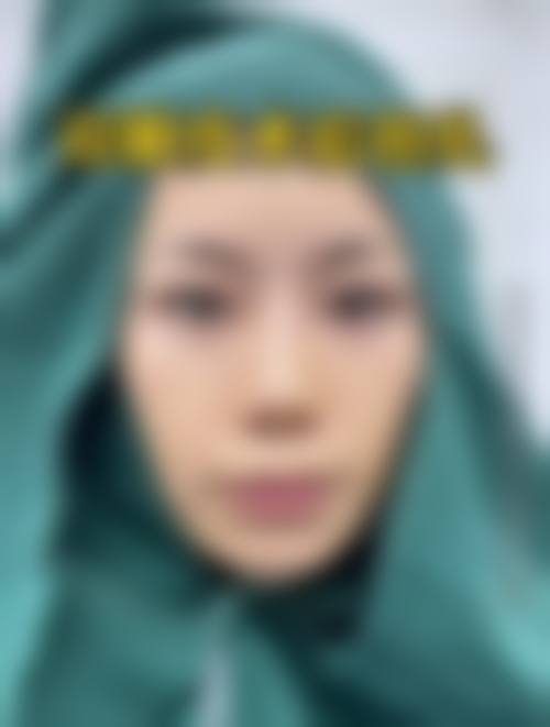 青岛双华医疗美容门诊部怎么样价格收费