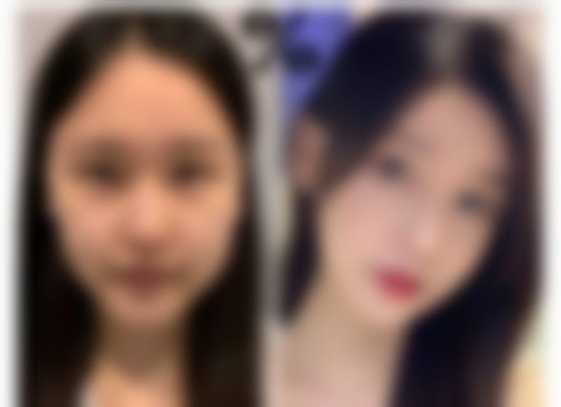 李梅医生的价格与询问方式