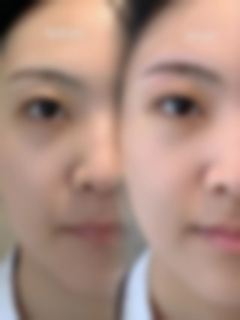 龙昕医生的手术价格