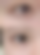 赵丽达医生的技术优势