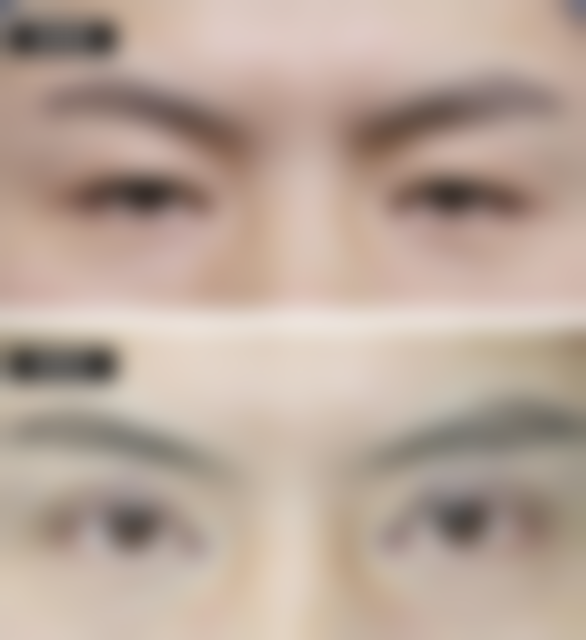 海南美咖医疗美容医院怎么样价格收费