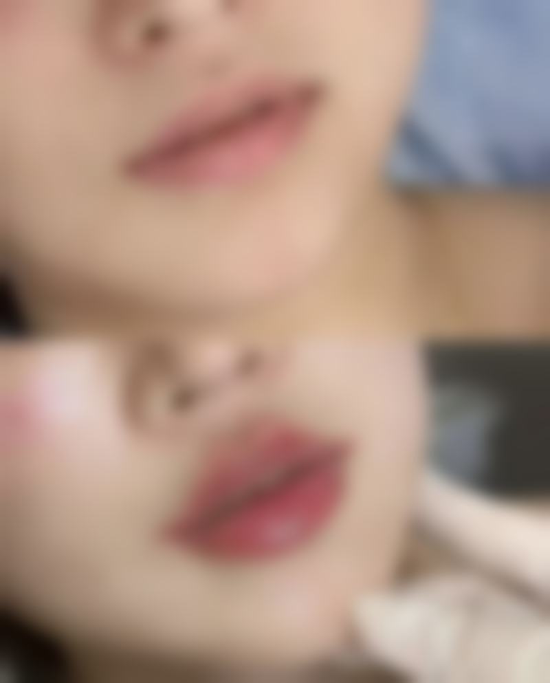 郑荣福医生助力美丽蜕变