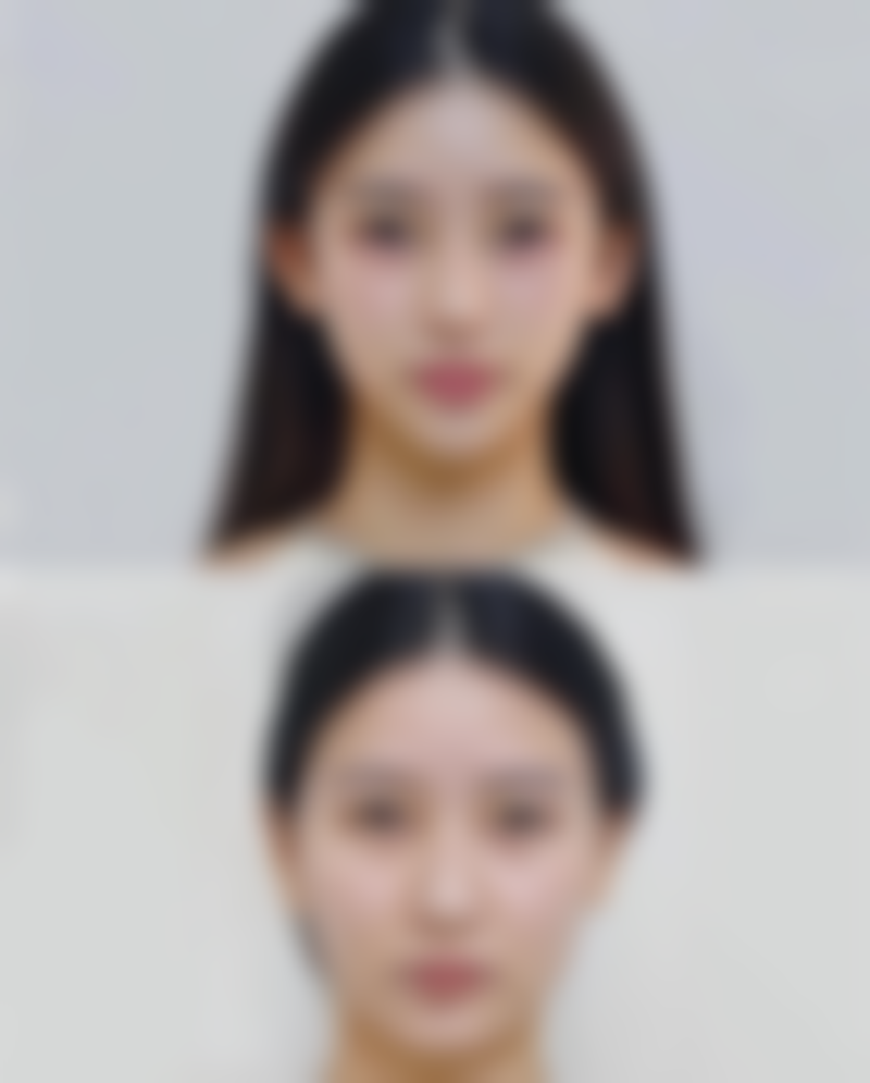 雪纖瘦医疗美容怎么样特色项目及技术优势