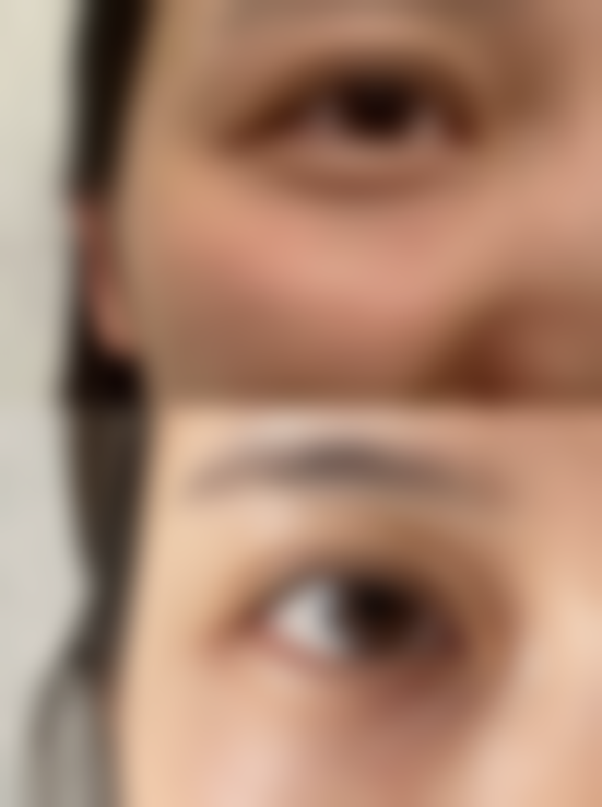 曹镜焕医生的临床成果