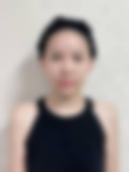 长沙唯姿奥拉克医疗美容门诊部怎么样求美者反馈