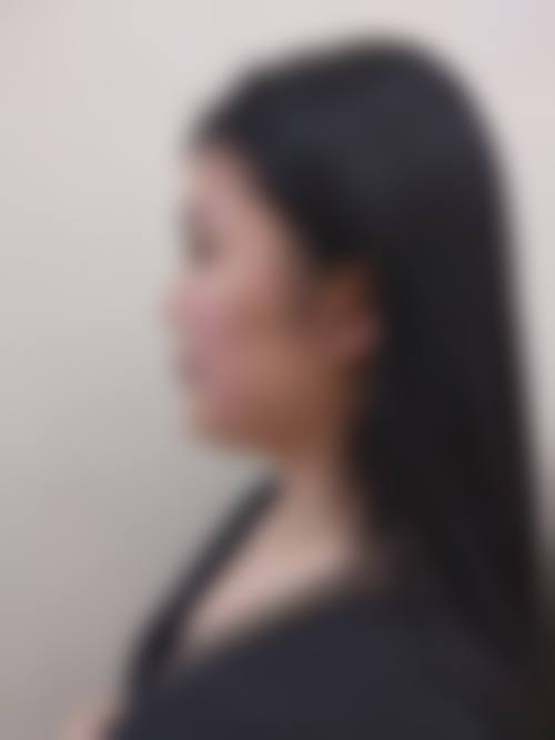 天津伊颜美医疗美容门诊怎么样价格收费