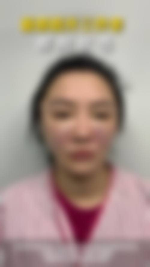 沈阳椤迪特医疗美容医院怎么样求美者反馈