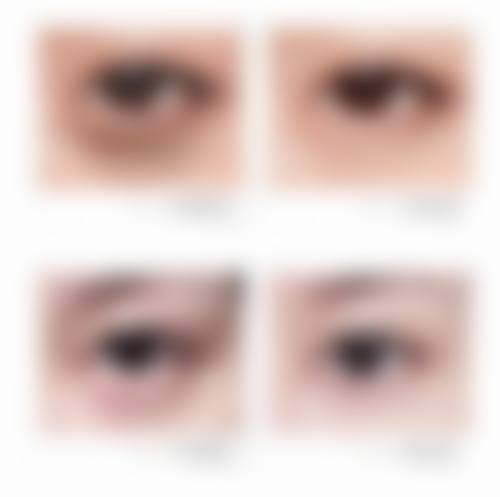 阜新矿业集团总医院整形美容科怎么样价格收费