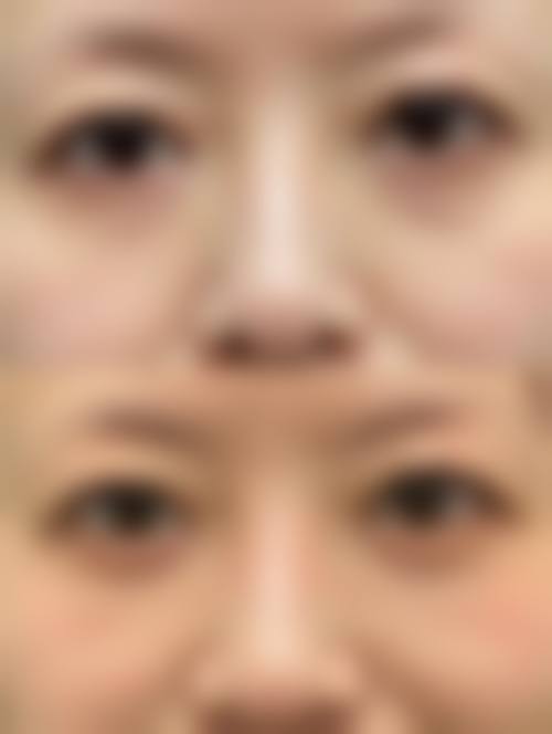 王玉珏医生的技术优势