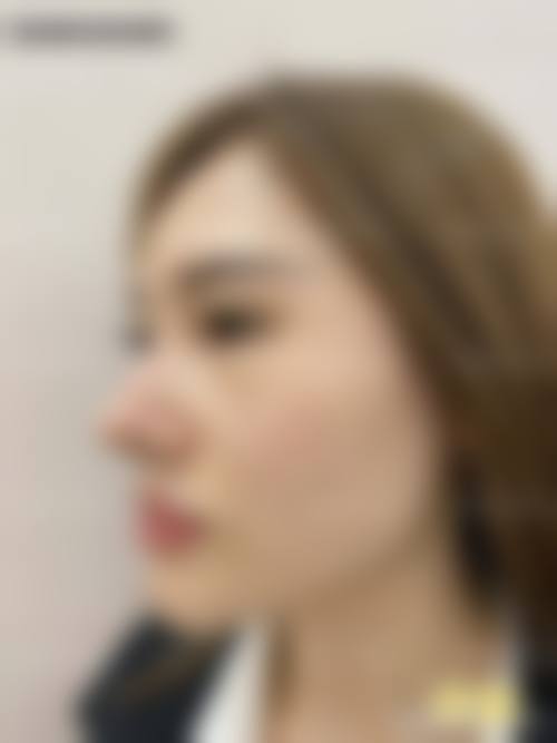 郑荣福医生的个性化服务：打造专属美丽