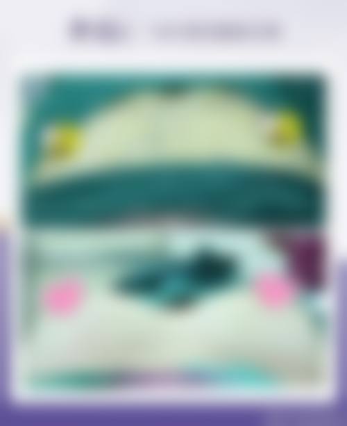 韩国Glam整形外科怎么样价格收费