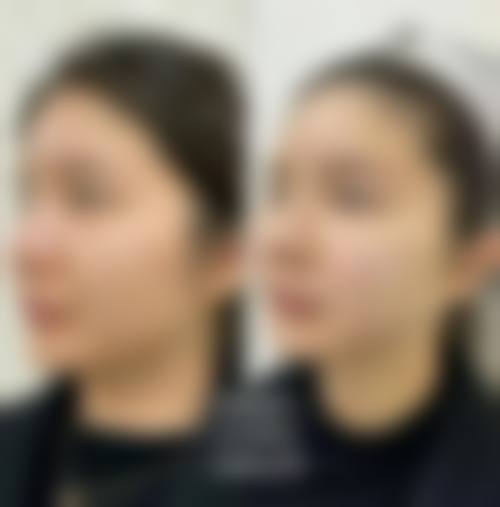 深圳市华医医疗美容诊所怎么样医生团队实力