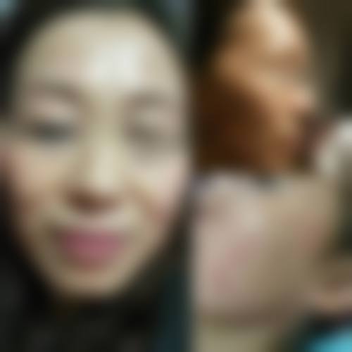 北京市海淀医院整形美容科怎么样求美者反馈