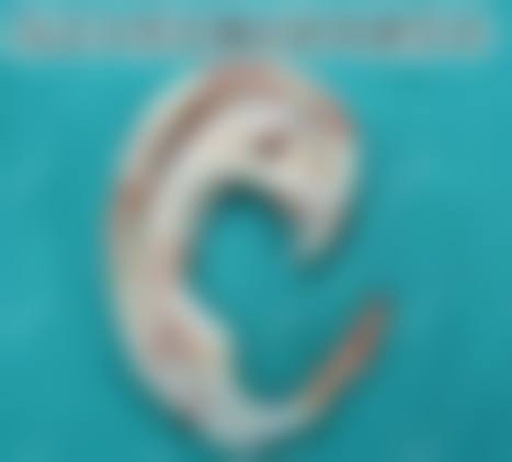 无锡伊尔美整形美容医院怎么样价格收费