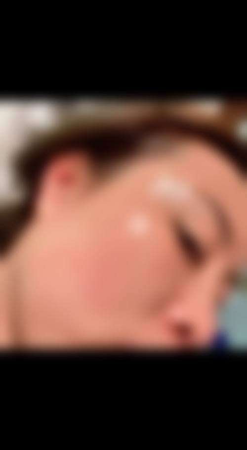 无锡伊尔美整形美容医院怎么样求美者反馈