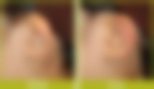 鞍山马大夫英威整形美容诊所怎么样求美者反馈