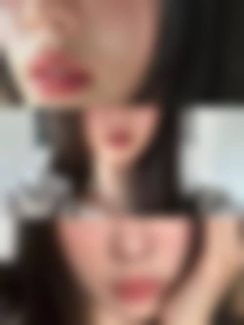 成都市第一人民医院整形美容科怎么样医生团队实力