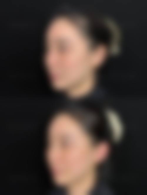 曲阜医联美雅致整形医院怎么样特色项目及技术优势