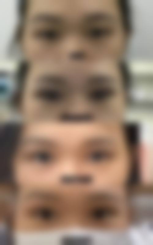 阜新矿业集团总医院整形美容科怎么样求美者反馈