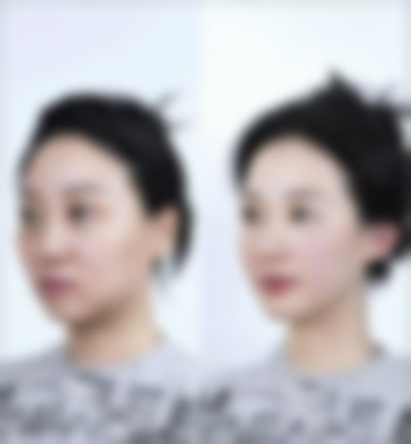 王玉珏医生的擅长领域