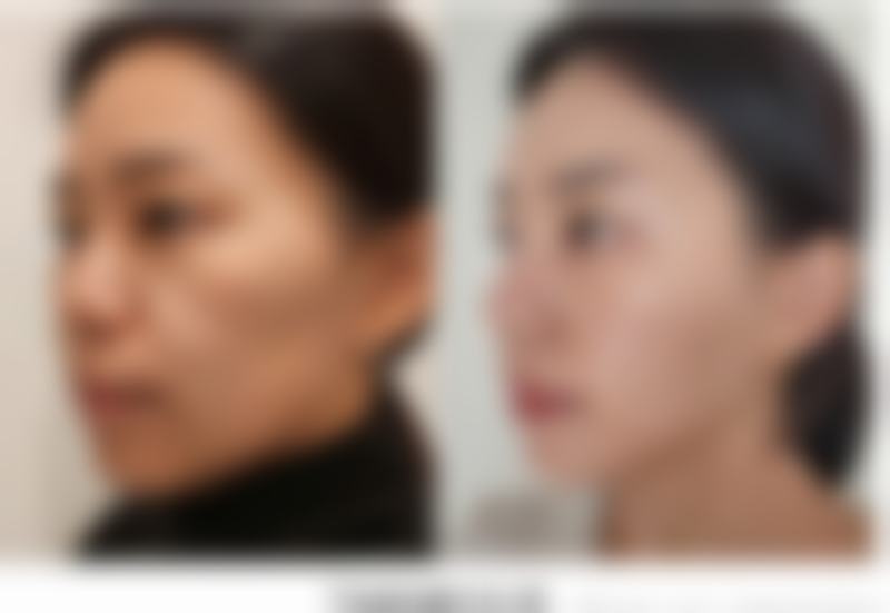 深圳市华医医疗美容诊所怎么样求美者反馈