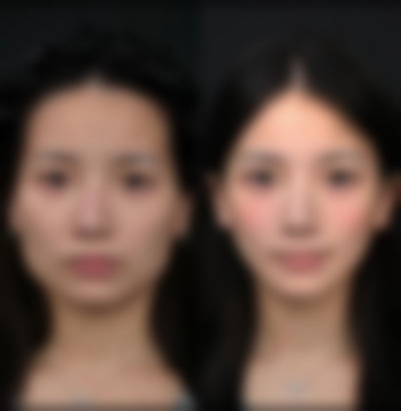 金敬勋医生的特色医美技术