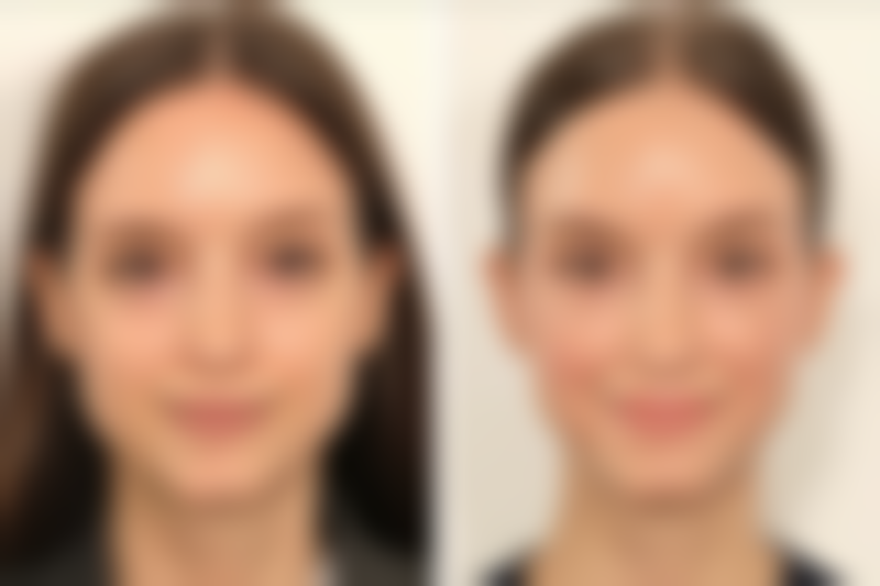 郑荣福医生：患者信赖的选择