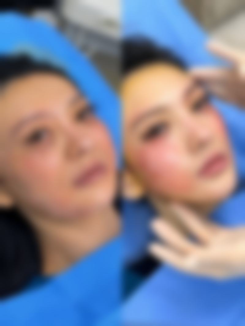 济宁星坊整形美容医院怎么样求美者反馈