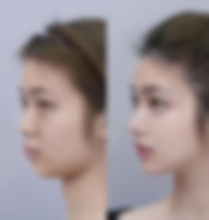 北京美泊整形怎么样价格收费