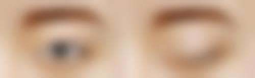 张济医生助力的美丽实例