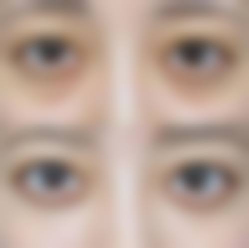 刘永丰医生擅长领域