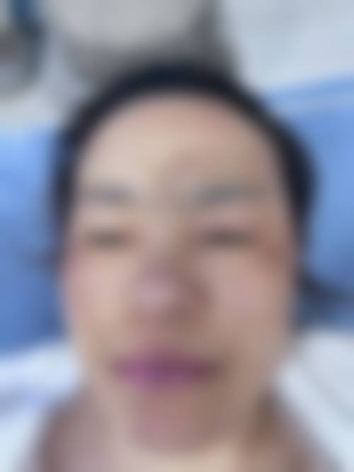 成都伊莎贝拉医疗美容医院怎么样特色项目及技术优势