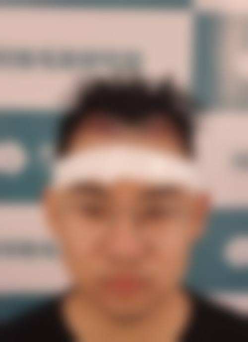 南宁大麦植发医疗美容诊所怎么样来院路线