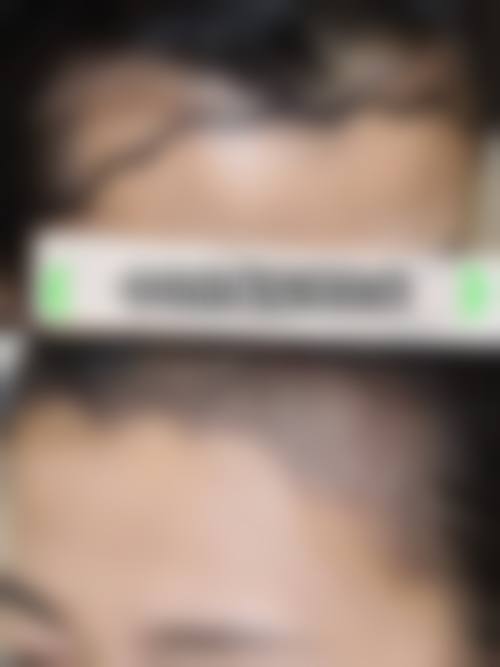 南宁大麦植发医疗美容诊所怎么样特色项目及技术优势