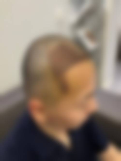 南宁大麦植发医疗美容诊所怎么样医生团队实力