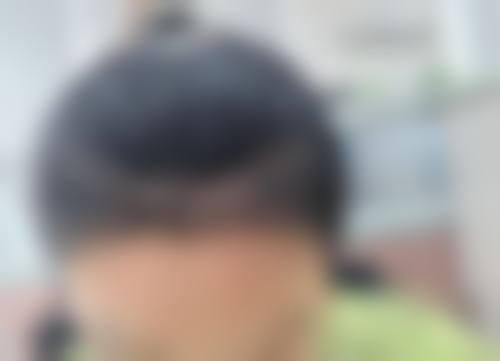 南宁大麦植发医疗美容诊所怎么样求美者反馈