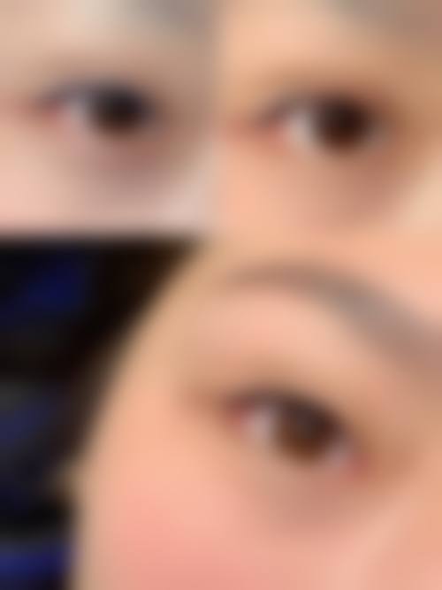 鞍山王静峙整形医疗美容诊所怎么样求美者反馈