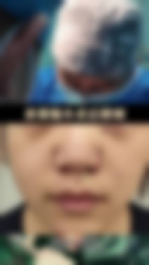 武汉锦颜医疗美容门诊部怎么样求美者反馈