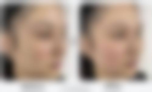 武汉鹏爱静港医疗美容门诊部怎么样来院路线